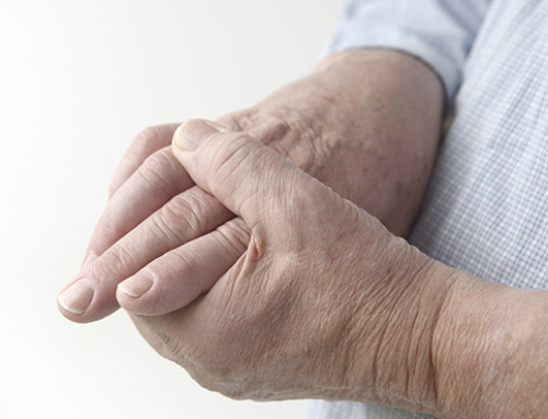 Fator Reumatóide e Artrite