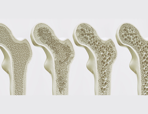 Tratamento da Osteoporose