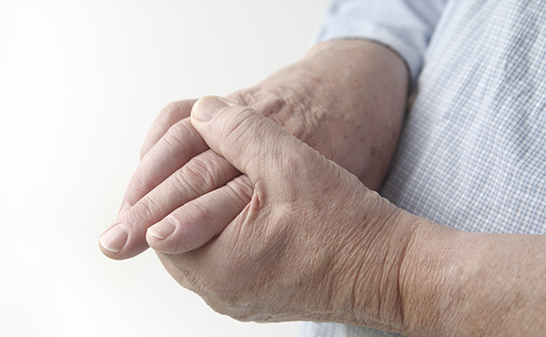Fator Reumatóide e Artrite